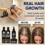 Moérie Hair Growth Shampoo, Conditioner, Spray and Mask for Men and Women, Hair ... - Image 5