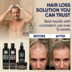 Moérie Hair Growth Shampoo, Conditioner, Spray and Mask for Men and Women, Hair ... - Image 6