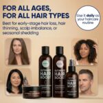 Moérie Hair Growth Shampoo, Conditioner, Spray and Mask for Men and Women, Hair ... - Image 7