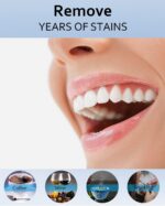 MySmile Teeth Whitening Gel Pen Refill Pack, 3 Non-Sensitive Teeth Whitening Pen... - Image 6