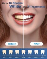 MySmile Teeth Whitening Gel Pen Refill Pack, 3 Non-Sensitive Teeth Whitening Pen... - Image 7