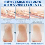 60% Urea with 2% Salicylic Acid Urea Foot Care Stick, Heel Stick for Cracked Fee... - Image 5