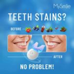 MySmile Teeth Whitening Kit with LED Light, 10 Min Non-Sensitive Fast Teeth Whit... - Image 4