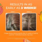 MARYRUTH'S Liquid Multivitamin + Hair Growth | Clinically Tested in Women for Th... - Image 4