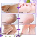 ALIVER Foot Peel Mask 3 Pack, Exfoliator Peel Off Calluses Dead Skin Callus Remo... - Image 6