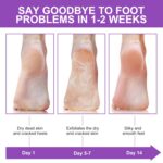ALIVER Foot Peel Mask 3 Pack, Exfoliator Peel Off Calluses Dead Skin Callus Remo... - Image 8