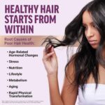 Force Factor Hair Growth Accelerator Soft Chews, Hair Growth Vitamins for Women ... - Image 9