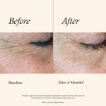 SkinMedica TNS Recovery Complex Facial Treatment - Advanced Growth Factor & Exos... - Image 5