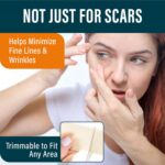 NUVADERMIS Silicone Scar Sheets for Surgical Scars - 120" x 1.5" Roll - Medical ... - Image 4