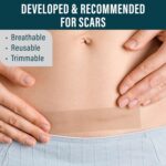NUVADERMIS Silicone Scar Sheets for Surgical Scars - 120" x 1.5" Roll - Medical ... - Image 5