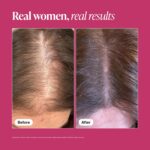 Viviscal Hair Growth Supplements For Women For Thicker, Fuller Hair, Nourishes T... - Image 6