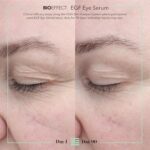 BIOEFFECT EGF Eye Serum with De-Puffer Rollerball | Age-Defying Under Eye Treatm... - Image 4