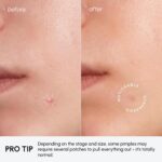 MAREE Invisible Pimple Patches - Clear Pimple Patches for Face - Hydrocolloid Ac... - Image 6