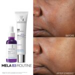 La Roche-Posay Mela B3 Serum, Dark Spot Corrector With Anti-Aging Melasyl + 10% ... - Image 7