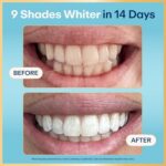 Lumineux Teeth Whitening Strips - 21 Treatments (3 Months) - Peroxide Free - Ena... - Image 3