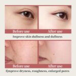 6-Piece Hydrating Vitamin C Skincare Set with Niacinamide, Daily Face Care Routi... - Image 8