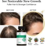 Natural Wellbeing Hair Essentials – DHT Blocker Hair Growth Supplement for Women... - Image 3
