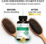 Natural Wellbeing Hair Essentials – DHT Blocker Hair Growth Supplement for Women... - Image 6