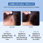 Botanic Hearth Hair Oil for Hair Growth | Rosemary Oil for Hair Growth with Biot... - Image 5