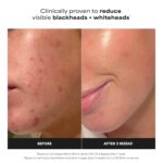 Paula's Choice SKIN PERFECTING 2% BHA Liquid Exfoliant with Salicylic Acid, Faci... - Image 3