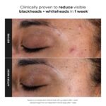 Paula's Choice SKIN PERFECTING 2% BHA Liquid Exfoliant with Salicylic Acid, Faci... - Image 5