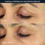 RoC Retinol Correxion Under Eye Cream for Dark Circles & Puffiness, Daily Wrinkl... - Image 5