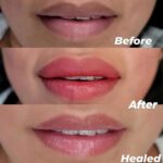 Lip Scrub Brush,Double-Sided Silicone Exfoliating Lip Brush Tool for Smoother an... - Image 5