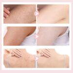 Super Soft Sunflower Suction Cup Bath Ball, 2025 New 2 in 1 Sunflower Exfoliatin... - Image 8