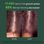 Rene Furterer TRIPHASIC Progressive Concentrated Serum, Thinning Hair Suitable f... - Image 4
