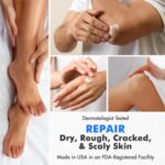 Ebanel Urea Cream 40% plus Salicylic Acid 2%, Foot Cream for Dry Cracked Heels F... - Image 5