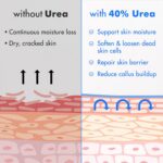 Ebanel Urea Cream 40% plus Salicylic Acid 2%, Foot Cream for Dry Cracked Heels F... - Image 6
