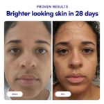 Bliss Vitamin C + Tri-Peptide Face Serum - Stabilized Vitamin C for Dark Spots, ... - Image 10