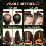 Batana Oil for Hair Growth - 100% Pure & Unrefined - Raw Natural Dr. Sebi Botana... - Image 5