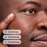 The Ordinary Salicylic Acid 2% Solution, Acne-Fighting Serum for Blemish-Prone S... - Image 5