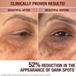 Charlotte Tilbury Radiance Recovery Dark Spot Serum - Tranexamic Acid & Vitamin ... - Image 3