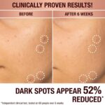 Charlotte Tilbury Radiance Recovery Dark Spot Serum - Tranexamic Acid & Vitamin ... - Image 5