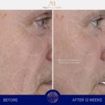 Augustinus Bader The Serum – Luxury Hydrating Anti-Aging Face Serum – Boosts Fir... - Image 4