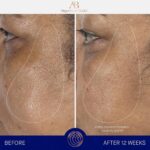 Augustinus Bader The Serum – Luxury Hydrating Anti-Aging Face Serum – Boosts Fir... - Image 6