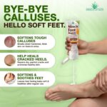 Miracle Foot Repair Cream, Foot Cream For Dry Cracked Feet, 8 Oz & 1 Oz | Miracl... - Image 4